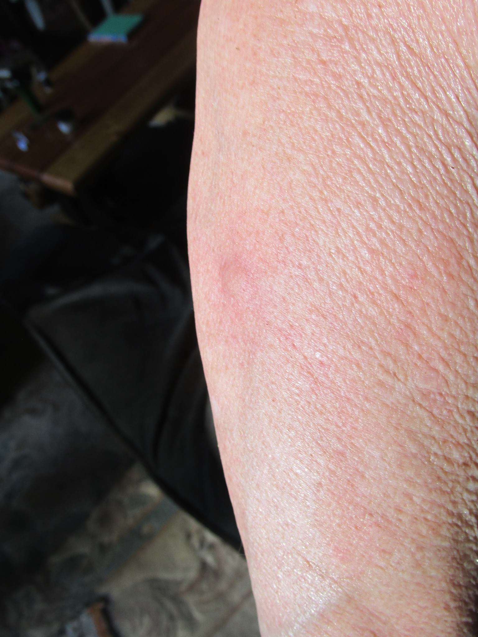 bite2